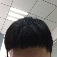 發(fā)際線用戶圖片