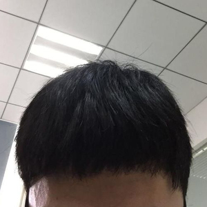 发际线分享社区