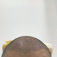 發(fā)際線用戶圖片