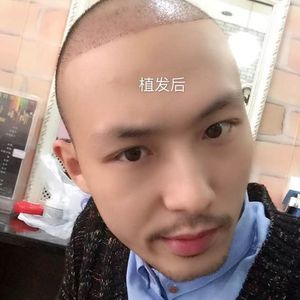 发际线分享社区