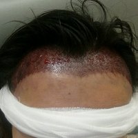 發(fā)際線用戶圖片