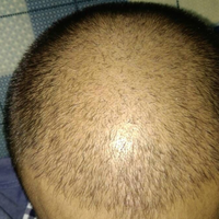 發(fā)際線用戶圖片