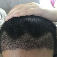 發(fā)際線用戶圖片