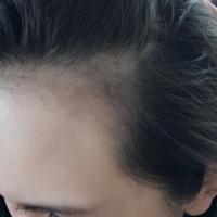 發(fā)際線用戶圖片