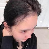 發(fā)際線用戶圖片