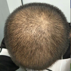 发际线分享社区