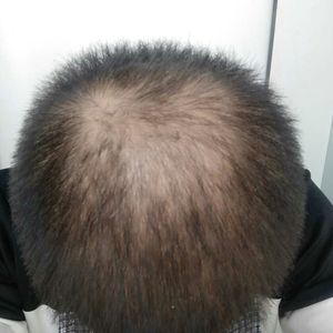 发际线分享社区