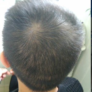 发际线分享社区