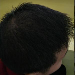 发际线分享社区