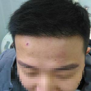 发际线分享社区