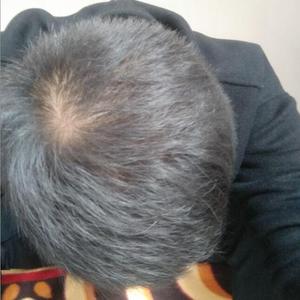 发际线分享社区