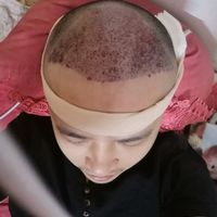 發(fā)際線用戶圖片