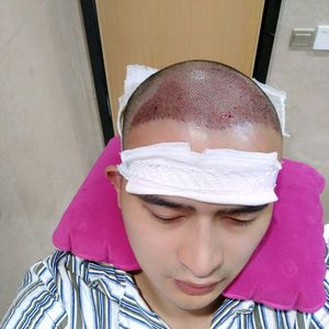 发际线分享社区