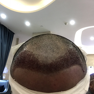 发际线分享社区