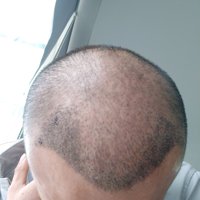 發(fā)際線用戶圖片