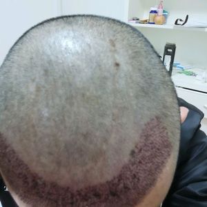 发际线分享社区