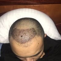發(fā)際線用戶圖片