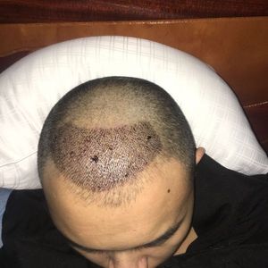 发际线分享社区