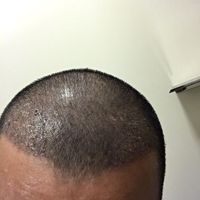 發(fā)際線用戶圖片