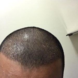 发际线分享社区
