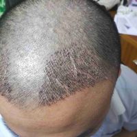 發(fā)際線用戶圖片