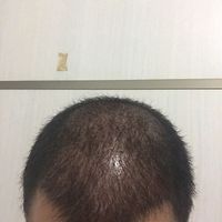 發(fā)際線用戶圖片