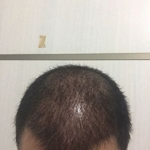 发际线分享社区