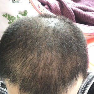 发际线分享社区