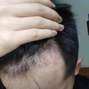 发际线分享社区
