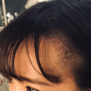 发际线分享社区