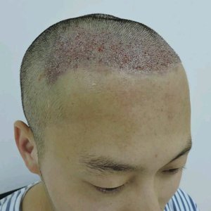 发际线分享社区