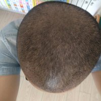 發(fā)際線用戶圖片