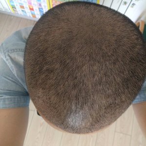 发际线分享社区