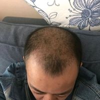 發(fā)際線用戶圖片
