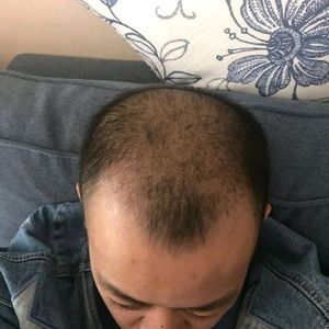 发际线分享社区