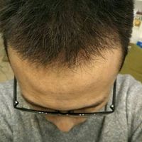 發(fā)際線用戶圖片