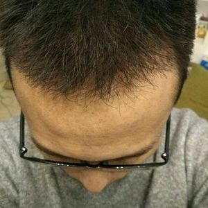 发际线分享社区