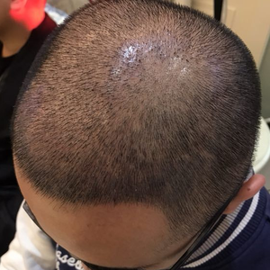 发际线分享社区