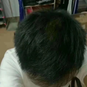 发际线分享社区