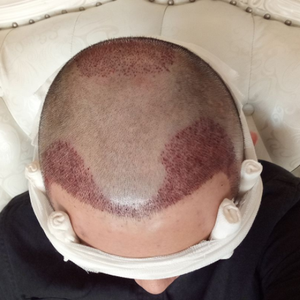 发际线分享社区