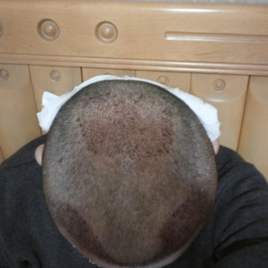 发际线分享社区
