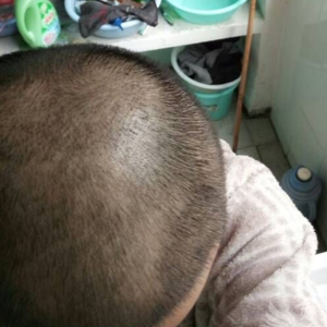 发际线分享社区