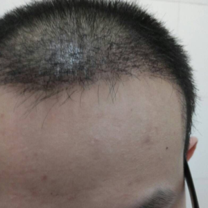 发际线分享社区