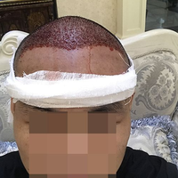 發(fā)際線用戶圖片