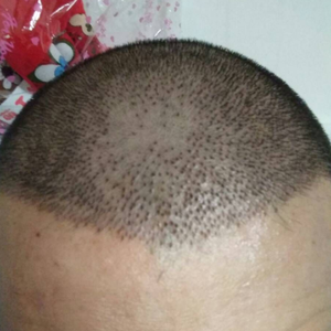 发际线分享社区