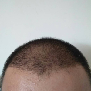 发际线分享社区