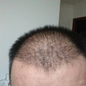发际线分享社区