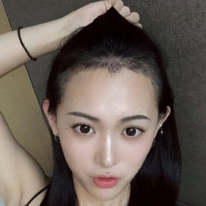 发际线分享社区