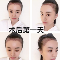 發(fā)際線用戶圖片