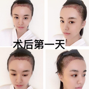 发际线分享社区